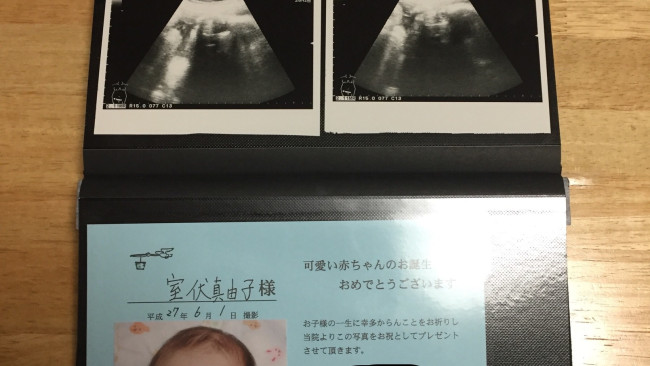 《マタニティライフの思い出♡》みんなどうしている？　妊娠中のエコー写真のまとめ方