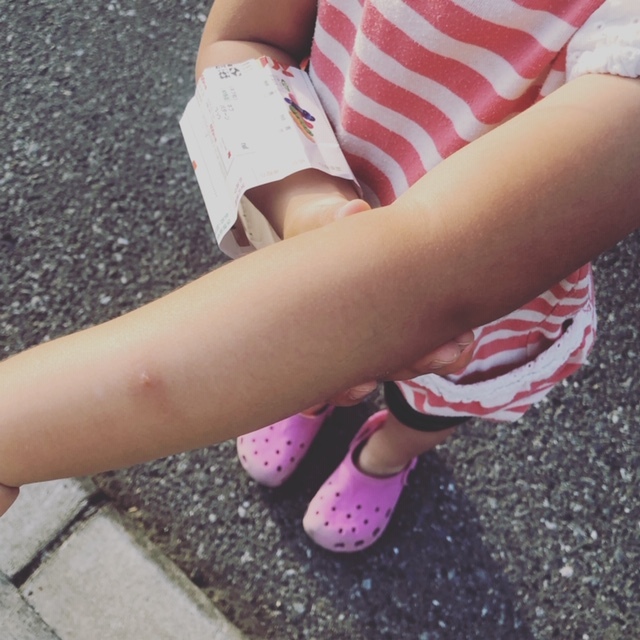 夏本番前にして、もう刺されはじめた我が子たち。かゆくて可哀想！